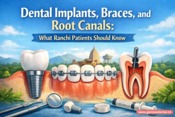 Dental Implants, Braces, and Root Canals: What Ranchi Patients Should Know